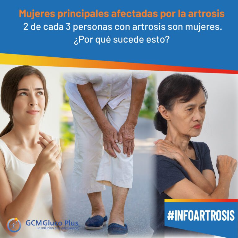 mujeres las mas afectadas por la artrosis